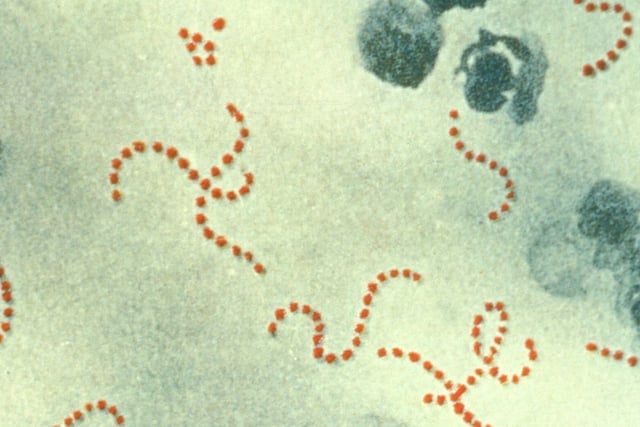Scarlet fever cluster at nursery