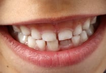 Letter to the editor: The case against fluoride varnishing