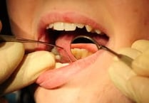 Top dentist says no to fluoride in tap water