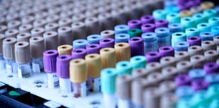 Rules on who can give blood to change