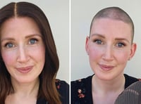 'Covid caused my hair loss but I wasn't going to let it take over'