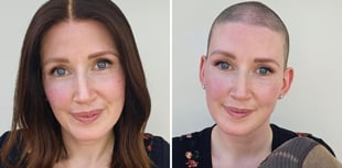 'Covid caused my hair loss but I wasn't going to let it take over'