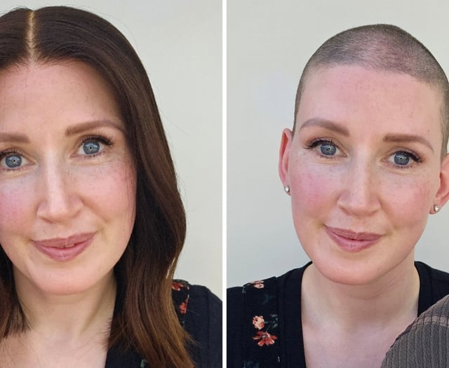 'Covid caused my hair loss but I wasn't going to let it take over'