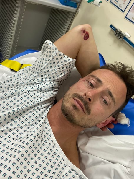Tom Weeden posted this selfie from his bed in Noble's Hospital on his Facebook page
