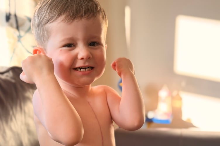 Arthur showing his scar