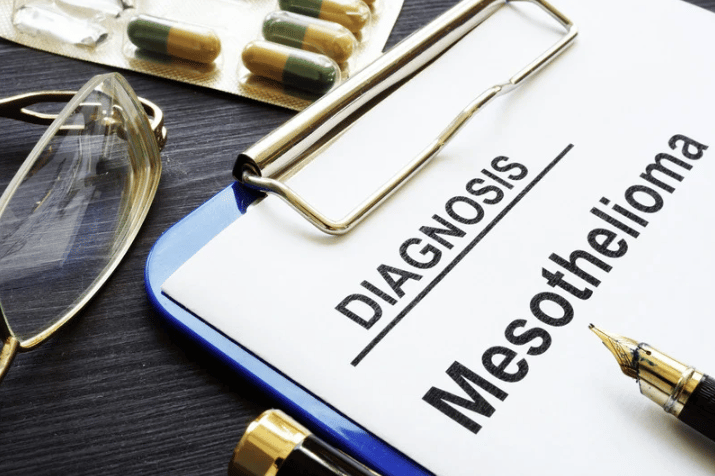 Mesothelioma diagnosis